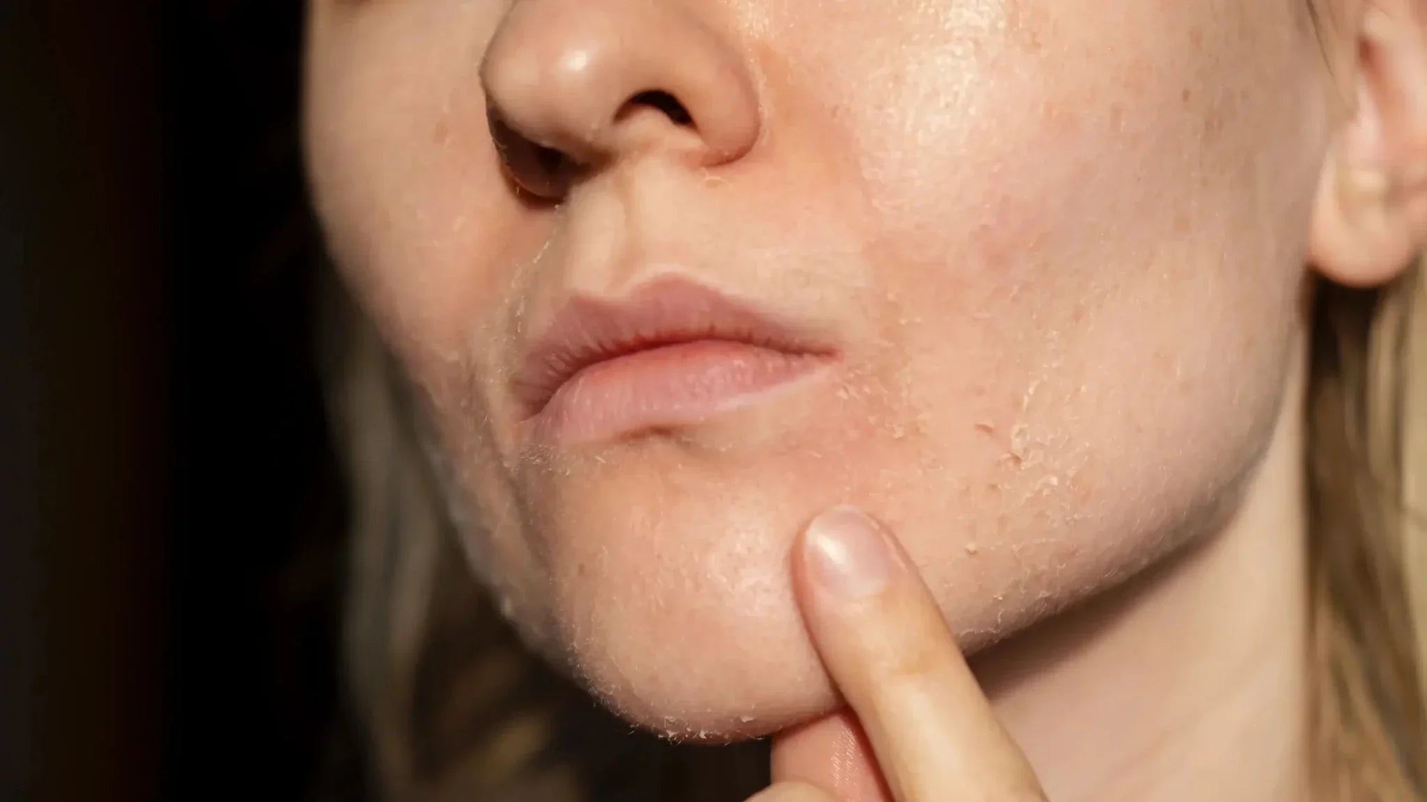 9 дерматологично доказани решения за суха кожа, които наистина работят - Al+ Cosmetics