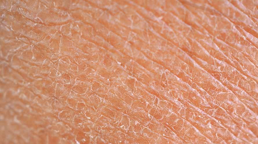 Cosmetic ingredients für trockene Haut that help prevent Feuchtigkeit loss - Al+ Cosmetics