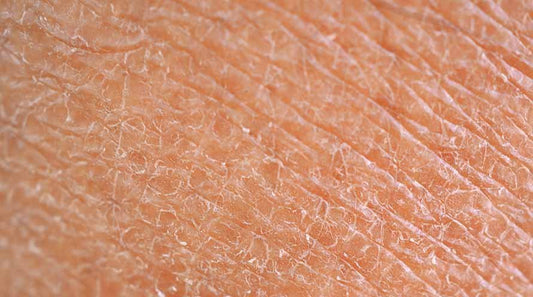 Козметични съставки за суха кожа, които помагат за предотвратяване на загубата на влага - Al+ Cosmetics