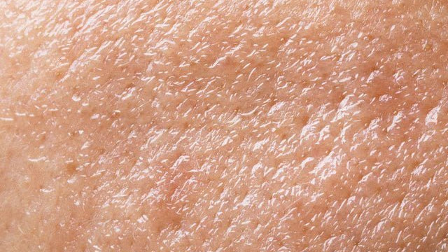 Мазна кожа: Какво трябва да знаете за този тип кожа? - Al+ Cosmetics