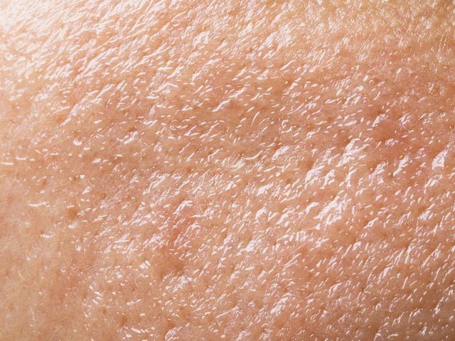 Oily Haut: What you need to know about this Haut type - Al+ Cosmetics