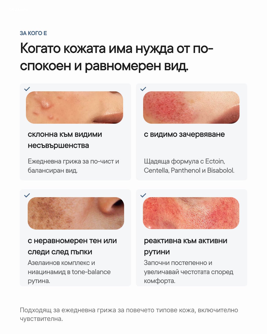 Azelia+ | Азелаинов серум за петна и пъпки - Al+ Cosmetics - 30 ML | Triple Azelaic Complex | AM/PM