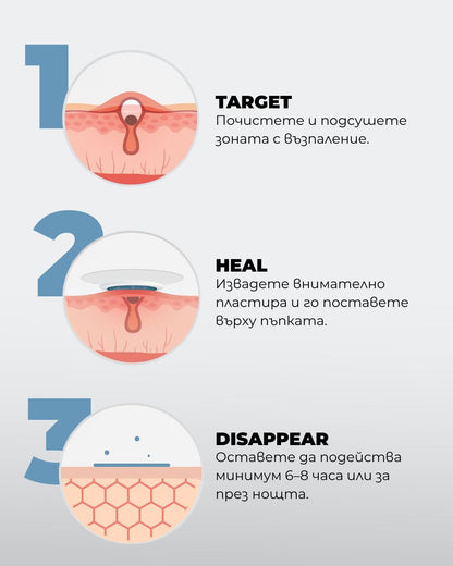 Spotless+ Хидроколоиден пластир срещу пъпки - Al+ Cosmetics - 23 хидроколоидни пластира за пъпки by Al+
